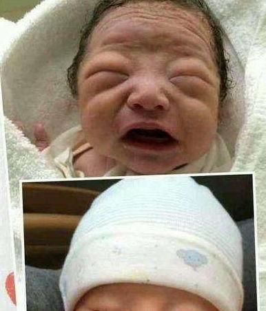 欧美新生丑婴儿图片